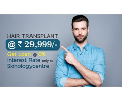Hair Transplant Cost in Bangalore