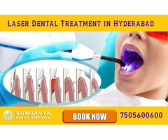 Laser Dental Treatment in Hyderabad