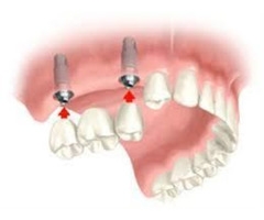 Do You Want Highly Trained Dentists & Technicians? - 2