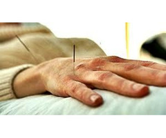 Do You Want Chinese Cupping Therapy In Perth??
