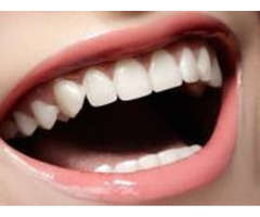 Cosmetic Dentist Los Angeles, CA - 3