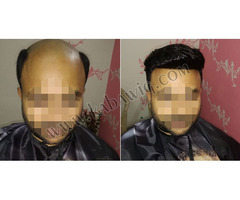 Hair Wig Shop in Delhi