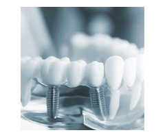 Helping Patients With Their Cosmetic Dentistry Needs - 3